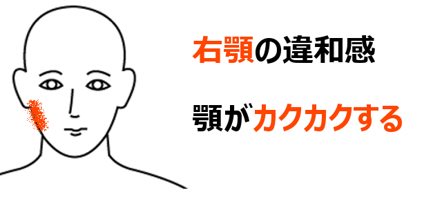 右顎の違和感